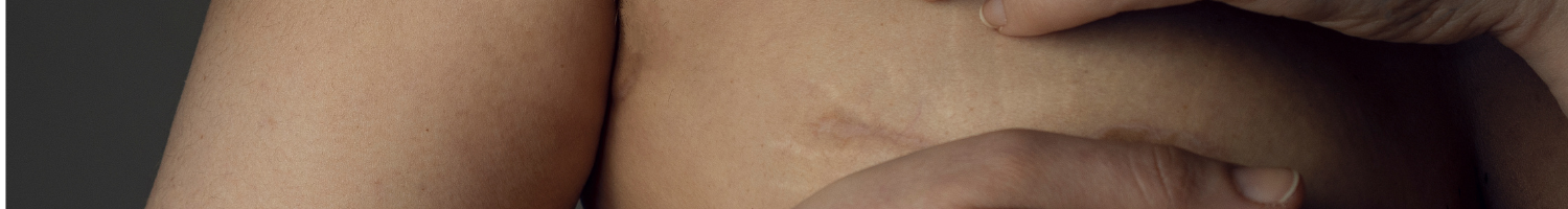 2025 EMH Multidisciplinary Breast Tumor Board (RSS) Banner